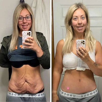 Parches GLP-1 – Apoyo diario para el control del apetito y el metabolismo